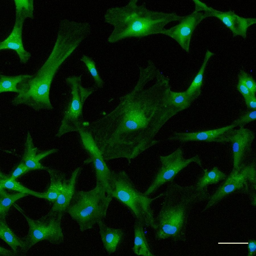 Fluorescence micrograph of cultured mesenchymal stem cells